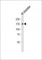MLCK Antibody (N-term)